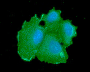 ICC IF of human CBR1 in Hep3B cells with DAPI and Alexa Fluor 488